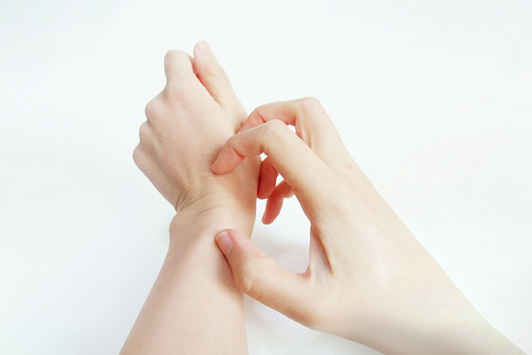 かゆみの疾患のイメージ