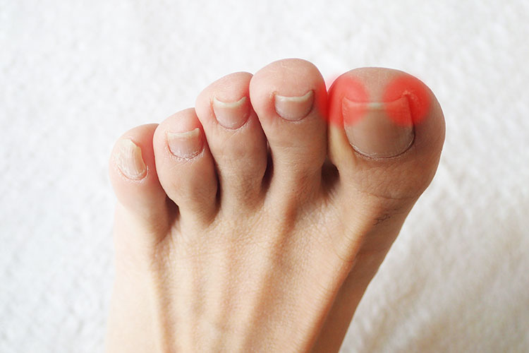 痛みの疾患のイメージ